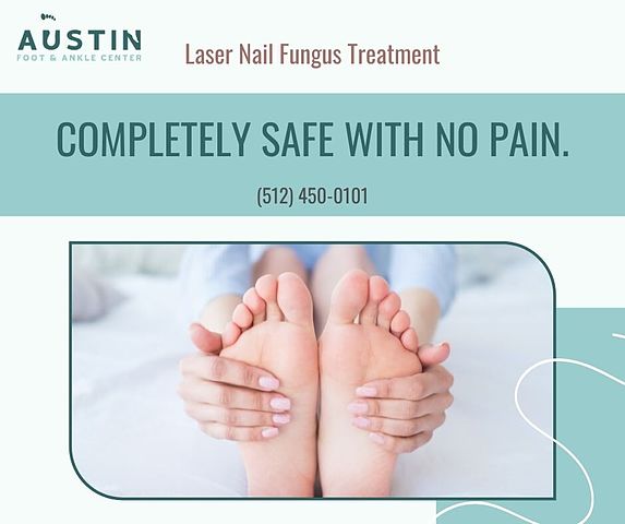 Laser Nail Fungus Treatment.jpg